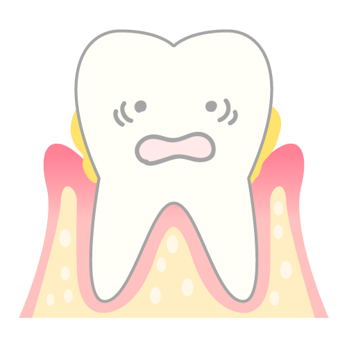 periodontosis_mechanism03